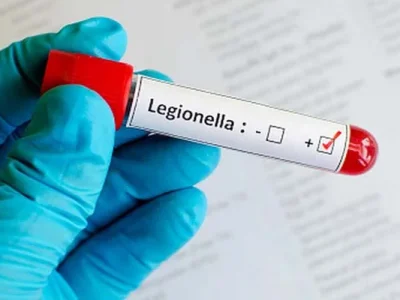 Outbreak Legionnaires Di London, Ontario: Satu Meninggal
