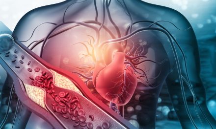 Aterosklerosis, Penyakit Pembuluh Darah yang Perlu Di Waspadai