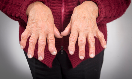 Rheumatoid Arthritis Di Tandai Peradangan Kronis Pada Sendi